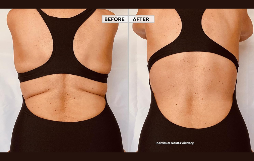 instant-lifts-before-and-after